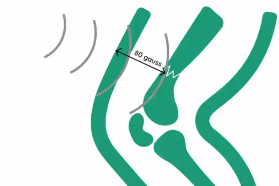 magnetoterapija_intenzitet.jpg.webp